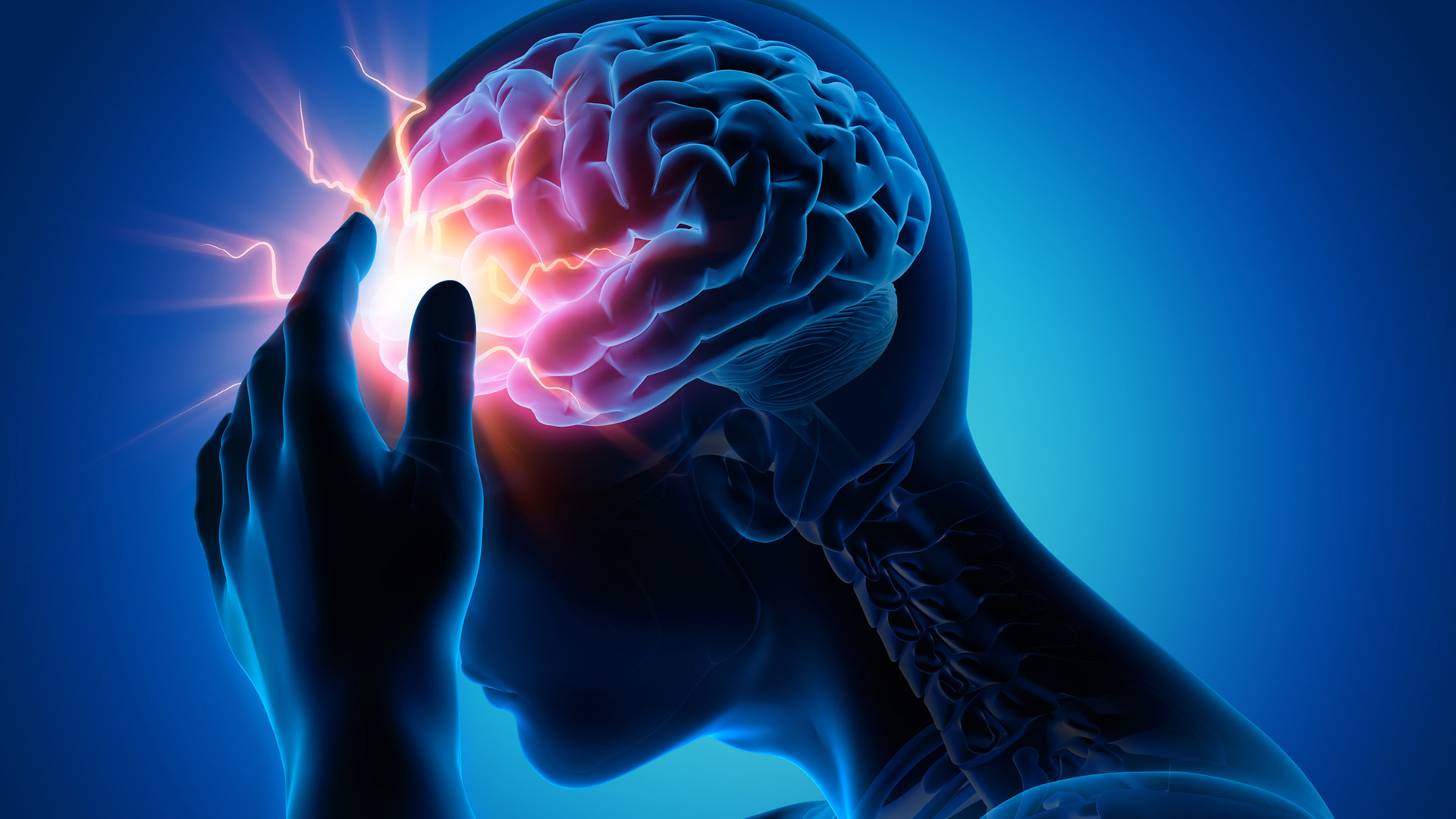 alzheimer