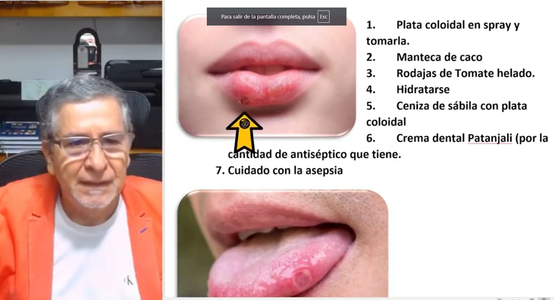 aftas