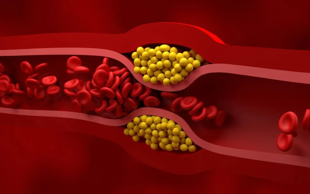 LIMPIAR LA SANGRE – DESINTOXICACION – CIRCULACION – COLON ESTREÑIDO