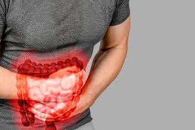 COLON IRRITABLE – COLON INFLAMADO – COLICOS INTESTINALES – ESTREÑIMIENTO – ALIMENTACION SALUDABLE