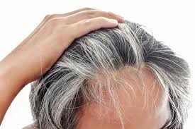 ¿POR QUÉ SALEN LAS CANAS?