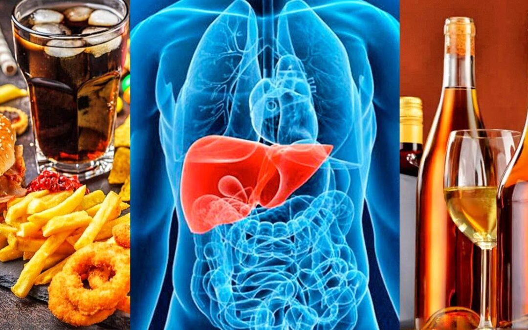 7 Alimentos Que Dañan Nuestro Hígado